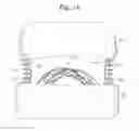 Fig. 08 - Intra-oral prostheses and other anatomical prostheses