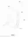 Fig. 02 - SELF-SUPPORTING PROSTHESIS FOR PLASTIC AND RECONSTRUCTIVE SURGERY