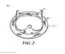 Fig. 03 - Valve holder with leaflet protection