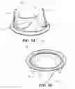 Fig. 04 - Valve holder with leaflet protection