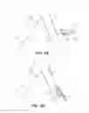 Fig. 46 - System for deploying a device to a distal location across a diseased vessel