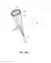 Fig. 66 - System for deploying a device to a distal location across a diseased vessel