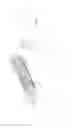 Fig. 76 - System for deploying a device to a distal location across a diseased vessel