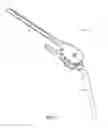 Fig. 02 - Elbow prosthesis