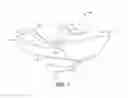 Fig. 08 - Elbow prosthesis
