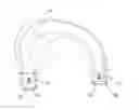 Fig. 01 - MENISCUS PROSTHESIS