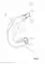 Fig. 03 - MENISCUS PROSTHESIS