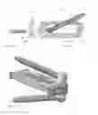 Fig. 13 - Intervertebral spacer and plate