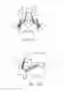 Fig. 26 - Devices and methods for transpedicular stabilization of the spine