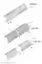 Fig. 08 - Stent Anti-Migration Mechanism