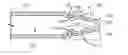 Fig. 01 - Universal catheter tip and methods for use