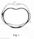 Fig. 02 - Back brace device