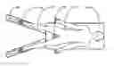 Fig. 01 - Method and Apparatus for Applying and Controlling Surgical Traction