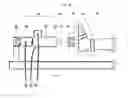 Fig. 03 - Method and Apparatus for Applying and Controlling Surgical Traction