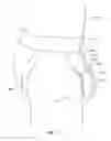 Fig. 08 - Incontinence Sack