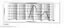 Fig. 02 - PHARMACEUTICAL COMPOSITION