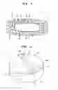 Fig. 02 - Dry coated tablet