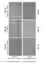 Fig. 08 - Treating soft tissue via controlled drug release