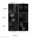 Fig. 07 - METHODS OF TREATING CANCER USING RAD51 SMALL MOLECULE STIMULATORS