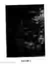 Fig. 02 - Methods of Reducing Mammographic Breast Density and/or Breast Cancer Risk
