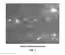 Fig. 02 - BRAIN SPECIFIC EXOSOME BASED DIAGNOSTICS AND EXTRACORPOREAL THERAPIES