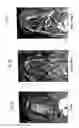 Fig. 03 - Platelet-Derived Growth Factor Compositions and Methods of Use Thereof