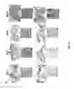 Fig. 04 - Methods of promotion of healing of diabetic wounds