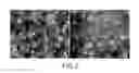 Fig. 03 - Method for treating ocular inflammation