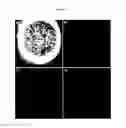Fig. 11 - Dendronized metallic oxide nanoparticles, a process for preparing the same and their uses