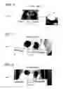Fig. 03 - Wound care compositions