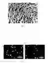 Fig. 05 - HYDROGEL BASED ON γ-POLYGLUTAMIC ACID AND ε-POLYLYSINE CROSSLINKED POLYMER, AND PREPARATION METHOD THEREFOR