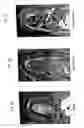 Fig. 03 - Platelet-derived growth factor compositions and methods of use thereof