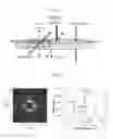 Fig. 02 - HEART VALVE