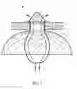 Fig. 02 - TRANSCATHETER INSERTION DEVICE AND METHOD