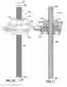 Fig. 11 - Fluid delivery system and method of fluid delivery to a patient