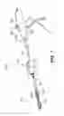Fig. 02 - Cuff-resistant anchoring balloon for medical device