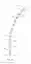Fig. 22 - Delivery assembly for percutaneously delivering and deploying an electrode array at a target location, the assembly including a steerable core around which the array is wrapped