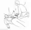 Fig. 01 - AED having CPR period with pause for ECG acquisition
