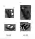 Fig. 07 - Selecting and correlating physical activity data with image data