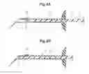 Fig. 05 - Applicator that allows easy mounting and removal of cartridge