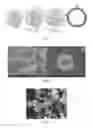 Fig. 02 - Process for the synthesis of nanostructured metallic hollow particles and nanostructured metallic hollow particles