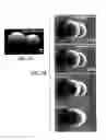 Fig. 04 - Stable undercooled metallic particles for engineering at ambient conditions
