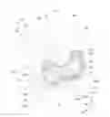 Fig. 01 - Vehicle