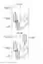 Fig. 19 - Vehicle movement state determination device and vehicle movement control device