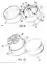 Fig. 09 - Variable Metered Dose Closure