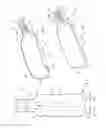 Fig. 03 - Container comprising a paperboard outer shell