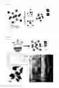 Fig. 02 - Method for preparing transition metal phosphide