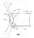 Fig. 07 - Removable nozzle assembly and gas transfer system