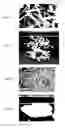 Fig. 02 - Method for crystallization of 2-amino-2-[2-[4-(3-benzyloxyphenylthio)-2-chlorophenyl]ethyl]-1,3-propanediol hydrochloride