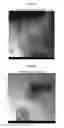 Fig. 06 - Compositions and methods for treating, including preventing, parvovirus infections and related diseases
